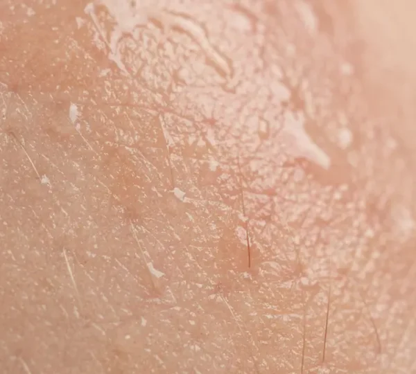 Peau naturelle avec texture douce et pH équilibré après micro-gommage biologique